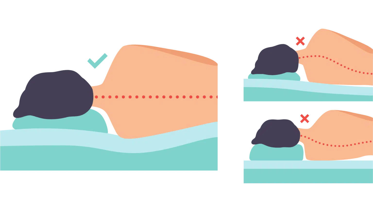 Correct posture for sleeping on your side